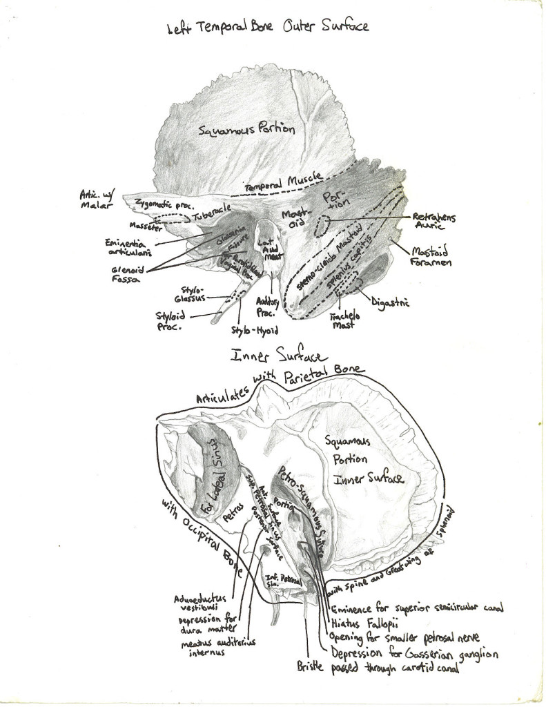 skull - temporal bone 2